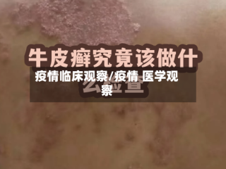 疫情临床观察/疫情 医学观察