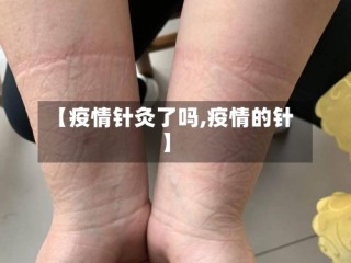 【疫情针灸了吗,疫情的针】