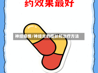 神经疫情/神经炎的症状和治疗方法