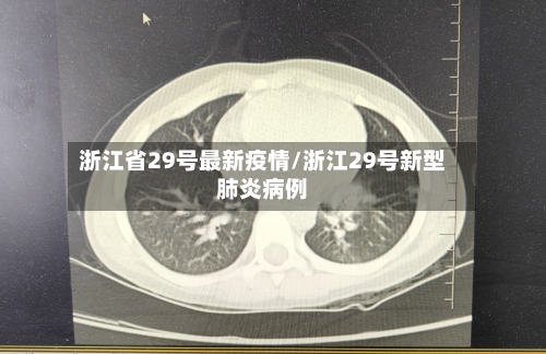 浙江省29号最新疫情/浙江29号新型肺炎病例-第1张图片