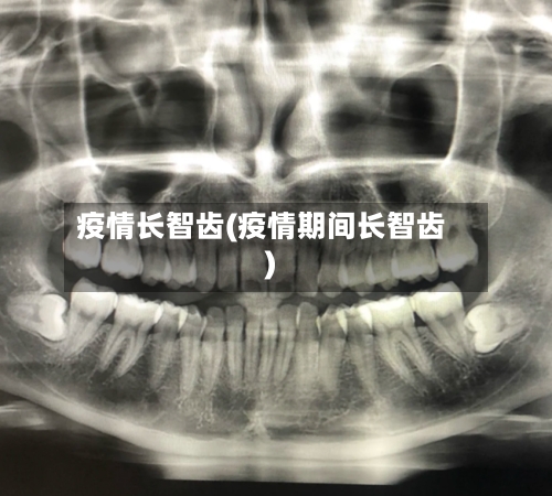 疫情长智齿(疫情期间长智齿)-第2张图片