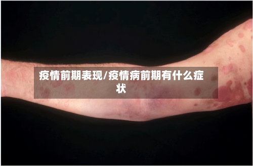 疫情前期表现/疫情病前期有什么症状-第3张图片