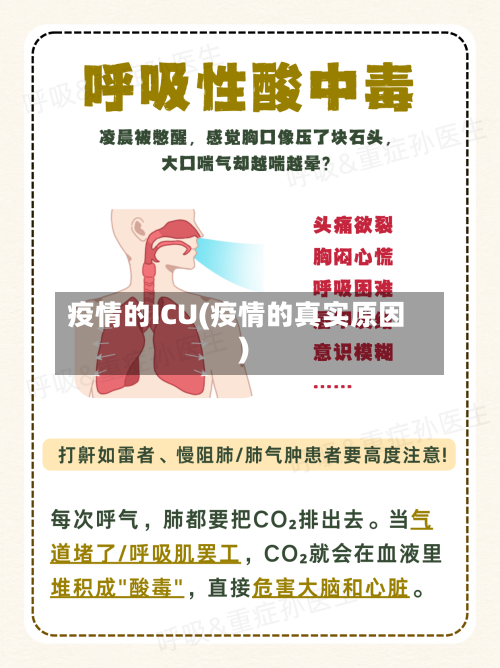 疫情的ICU(疫情的真实原因)-第1张图片