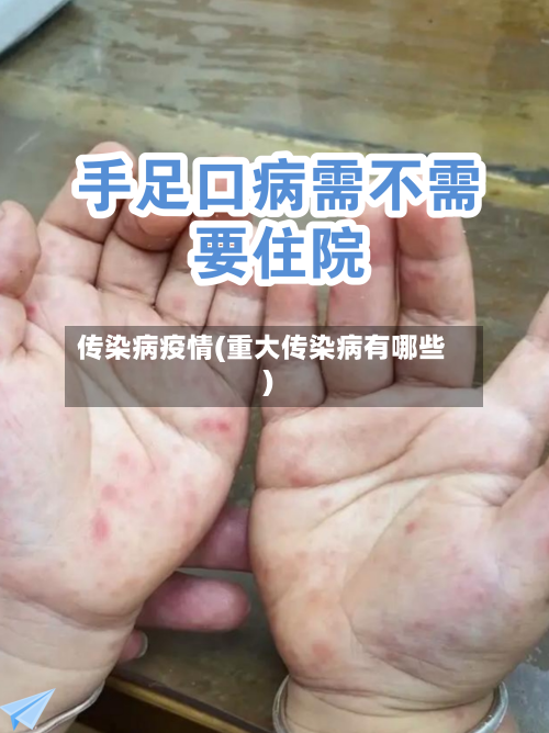传染病疫情(重大传染病有哪些)-第1张图片