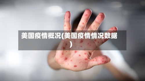 美国疫情概况(美国疫情情况数据)-第2张图片
